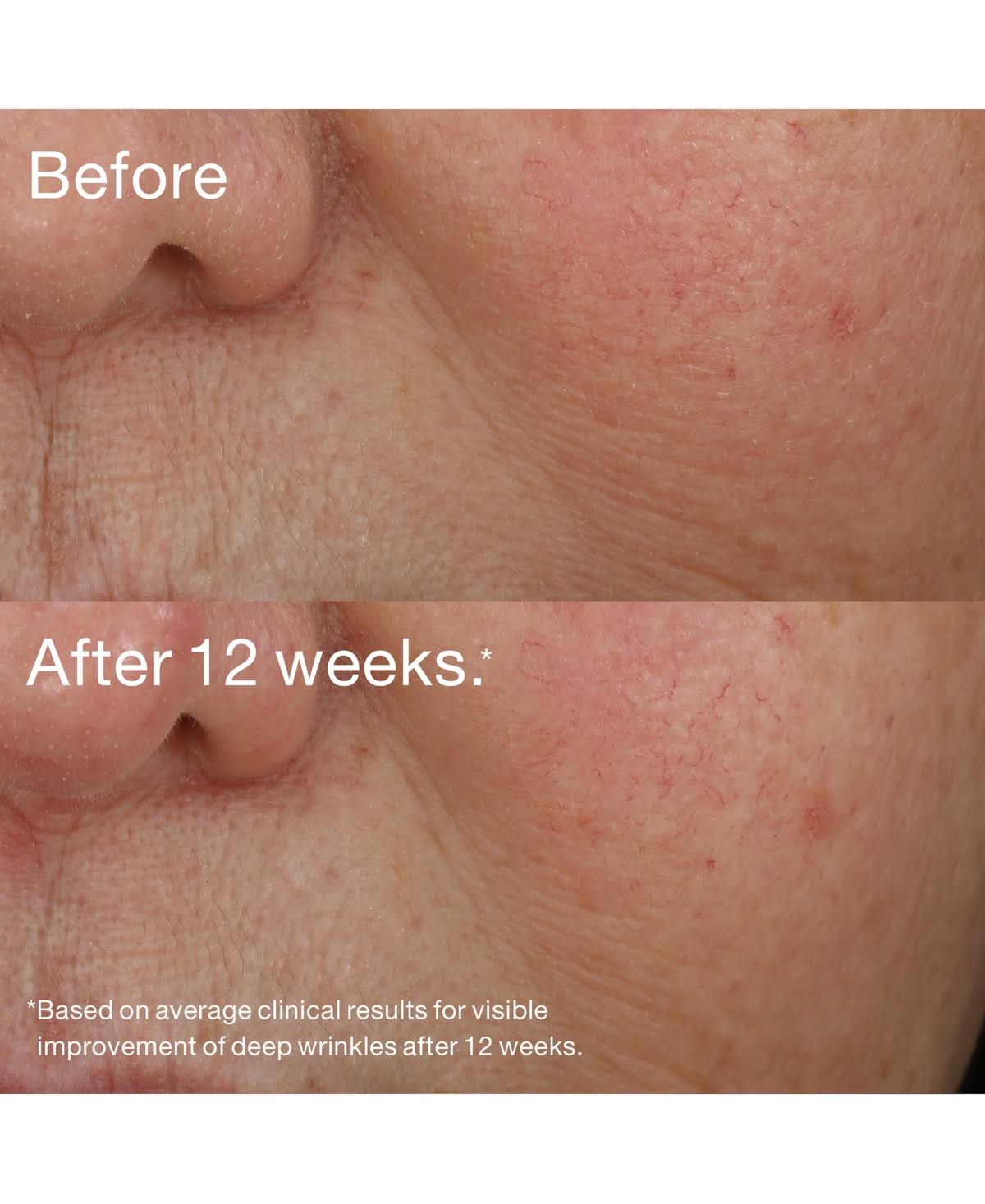Retinol Night Repair Treatment U673